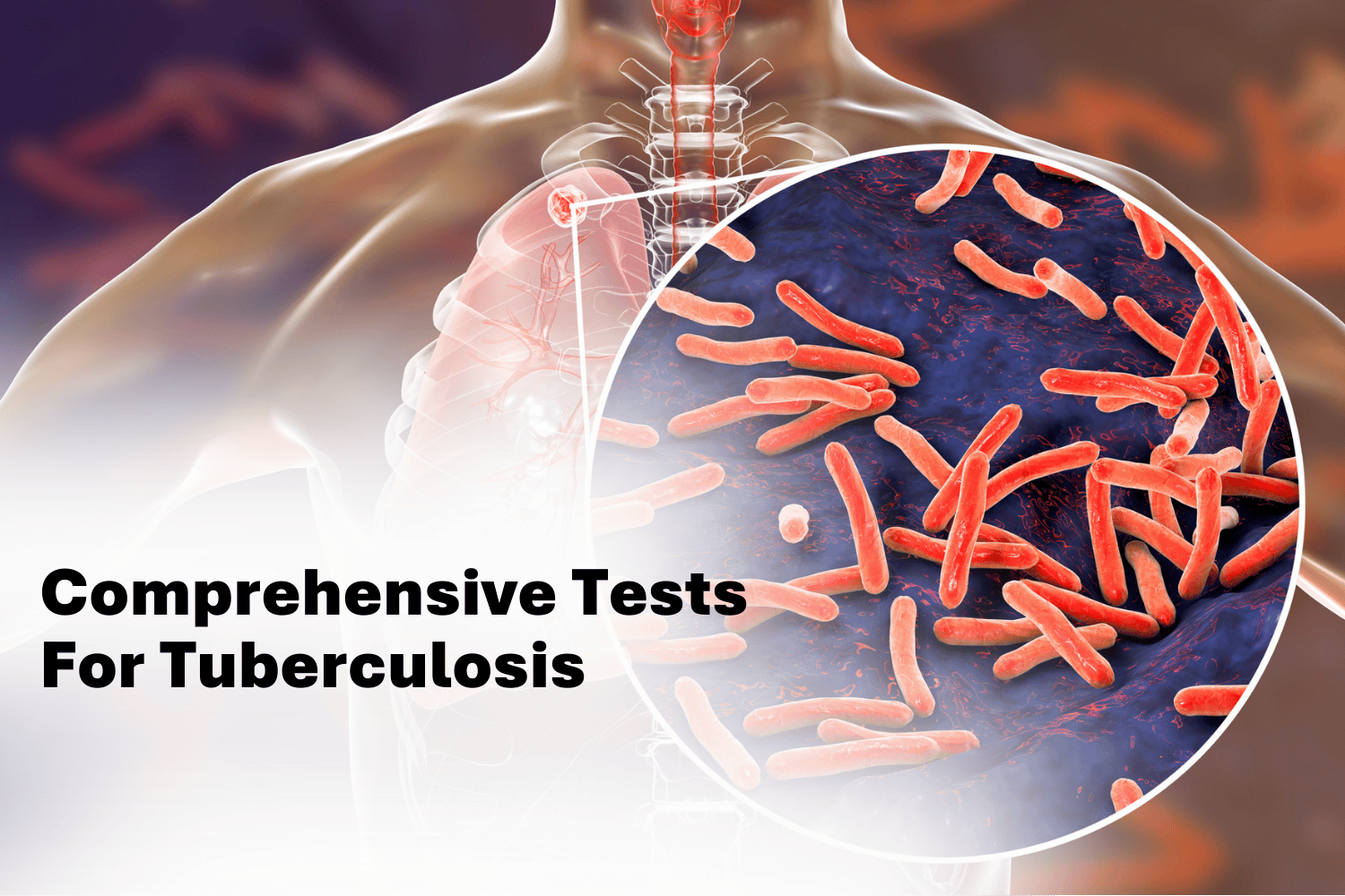 tuberculosis diagnostic tests