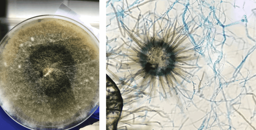 fungus